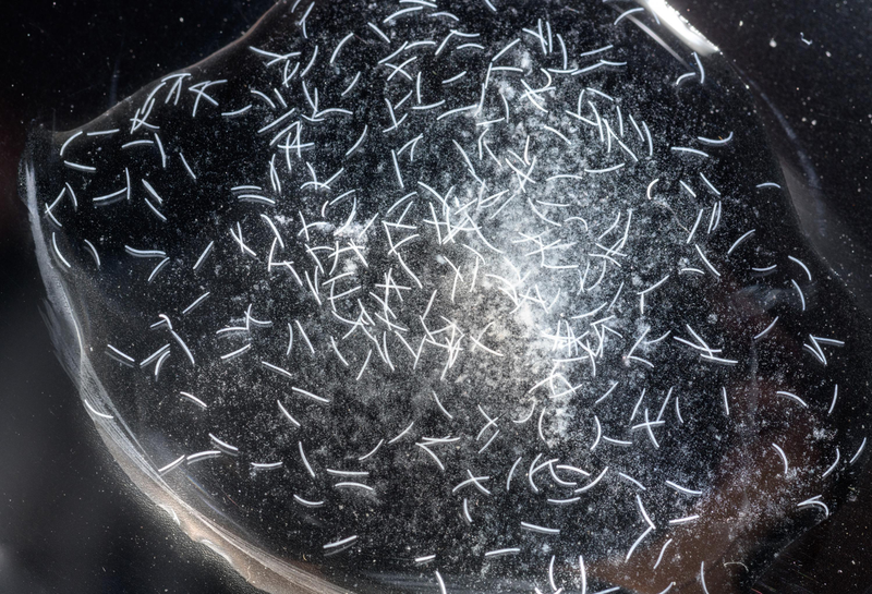 A batch of Spirostomum ambiguum.